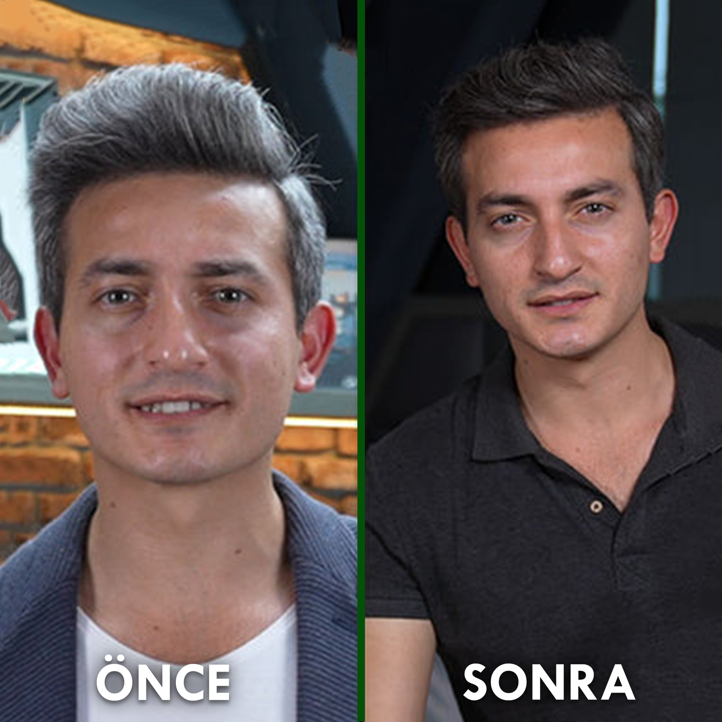 Nemina© Saç Beyazlama Karşıtı Doğal Sabun