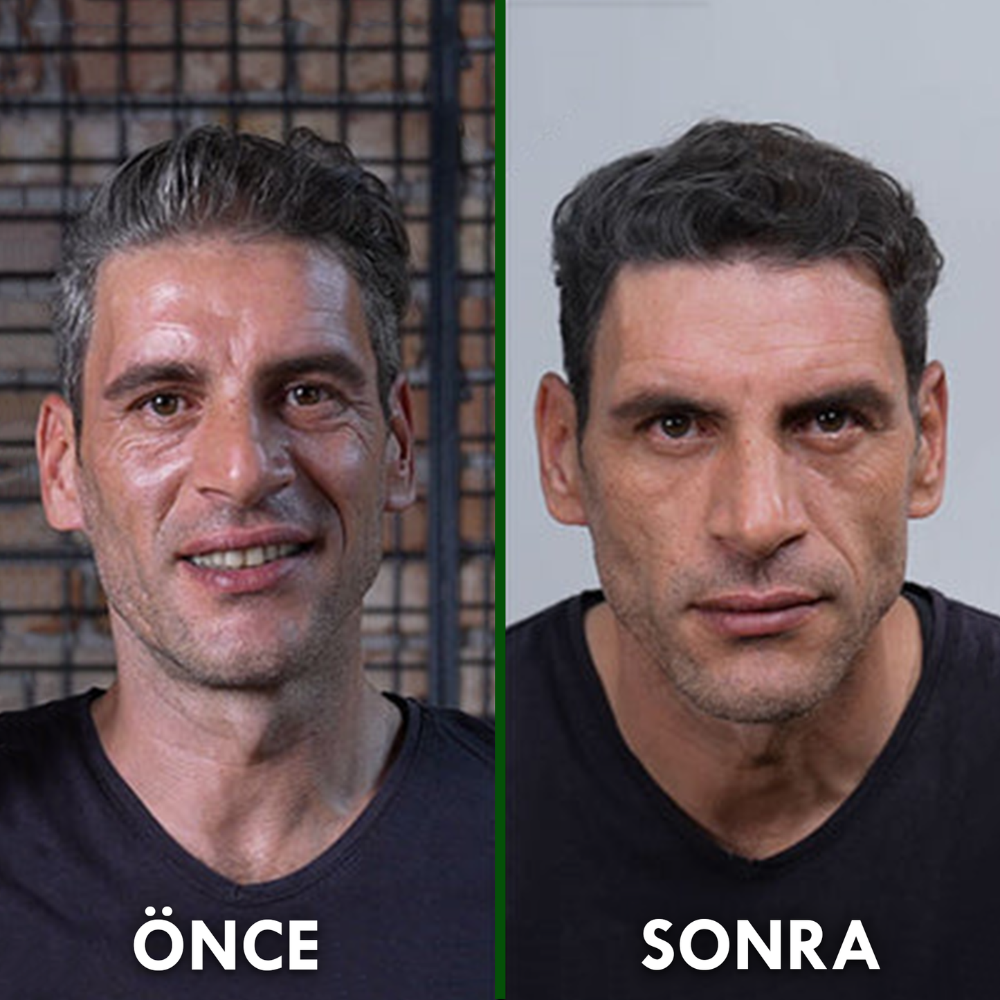 Nemina© Saç Beyazlama Karşıtı Doğal Sabun