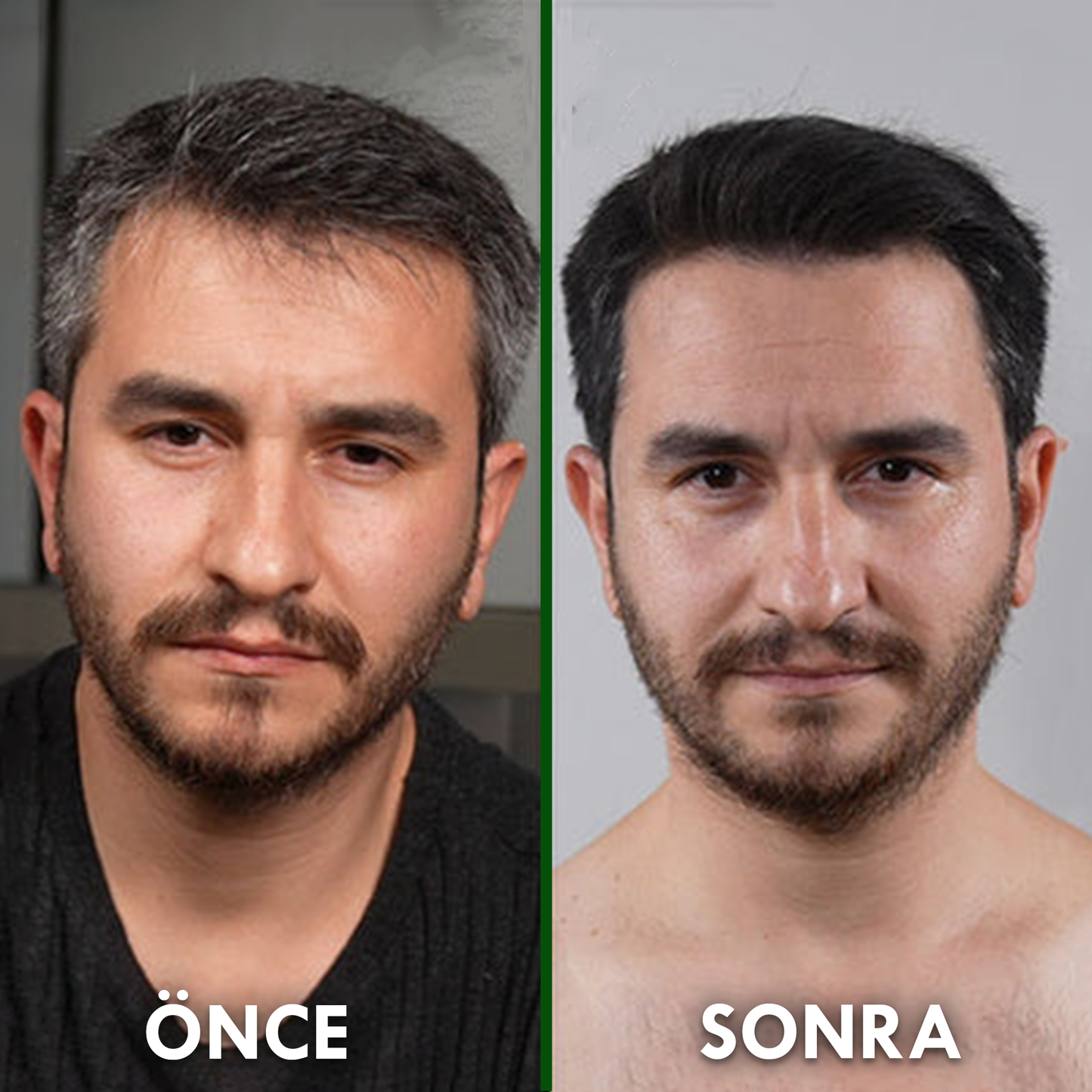 Nemina© Saç Beyazlama Karşıtı Doğal Sabun